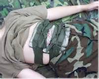 Dressing12" - Medical Care - Squad Trauma Aid Kit